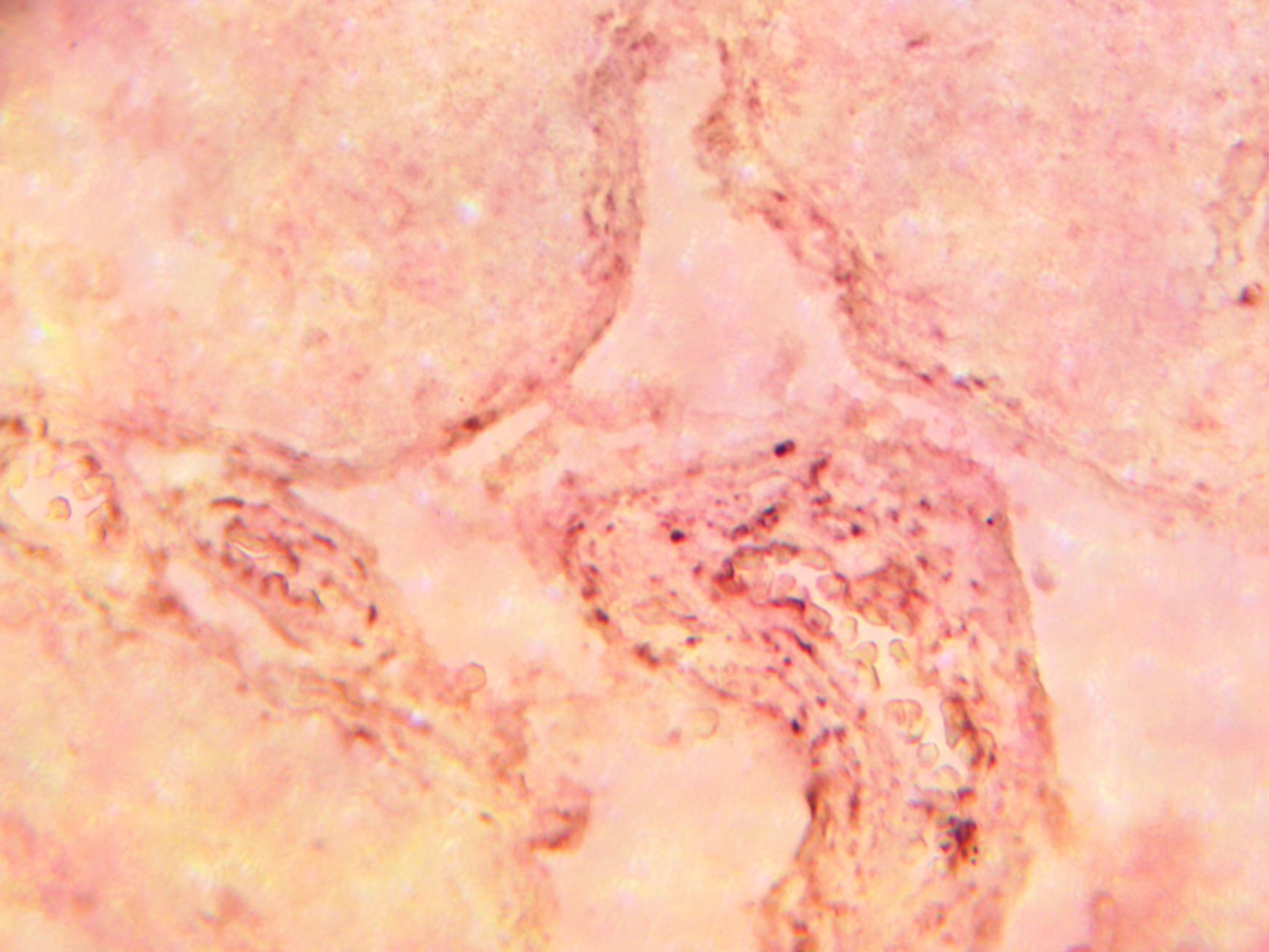 Immunohistochemical staining of normal human testis tissue using MGMT antibody (Cat. No. X2730P) at 10 µg/ml and detected using anti-Rabbit HRP secondary antibody and visualized using DAB substrate and hematoxylin counterstain.